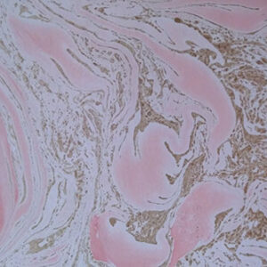 Swirl-Marble-Pink